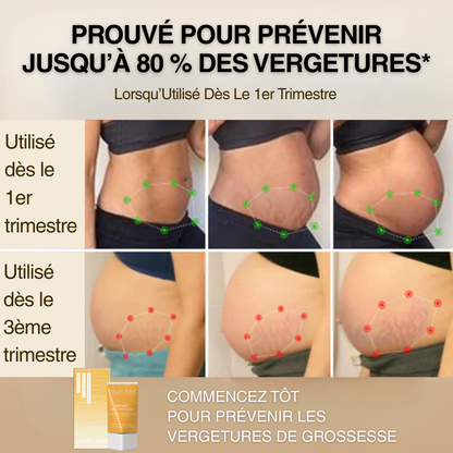 Crème Anti-Vergetures BioRepair™