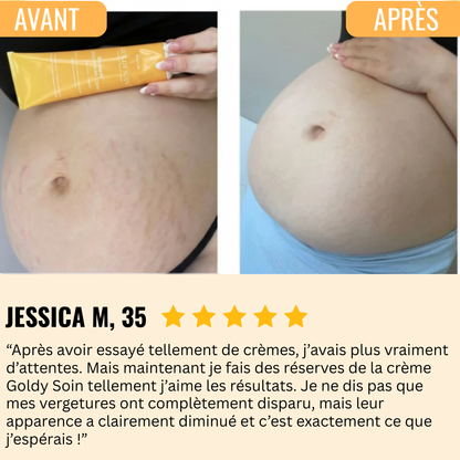 Crème Anti-Vergetures BioRepair™